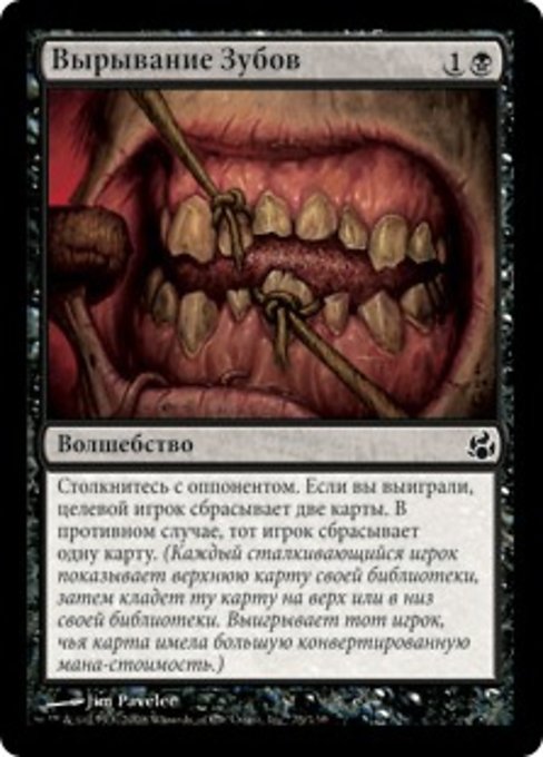 Вырывание Зубов